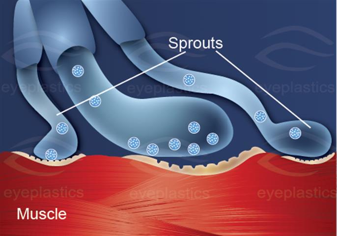 Normal neuromuscular junction