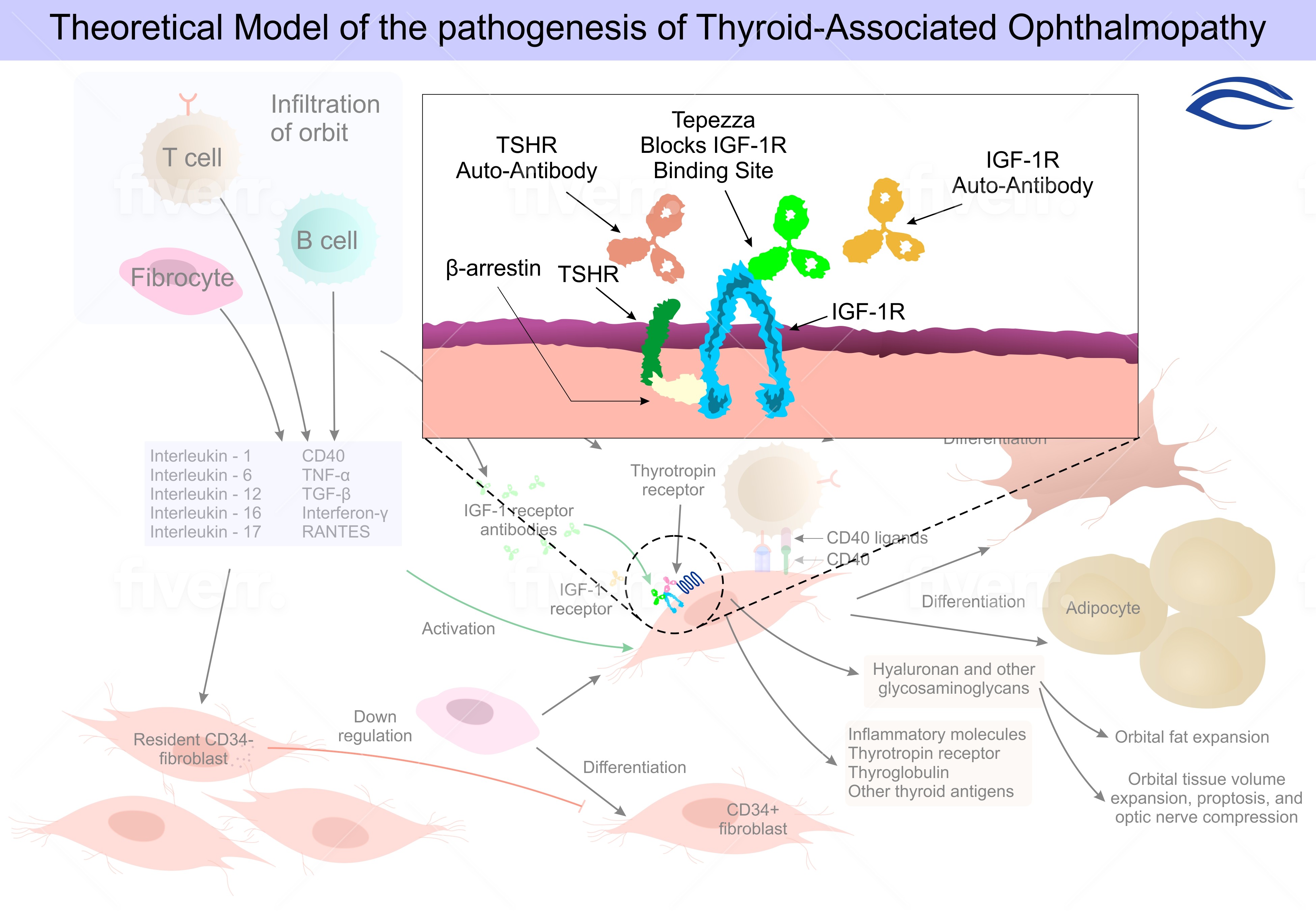 Tepezza treatment result &mdash; proptosis reduction in Thyroid Eye Disease